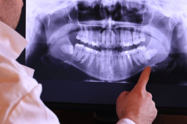 Best Emergency Dentist for Knocked-Out Tooth in Windcrest, TX