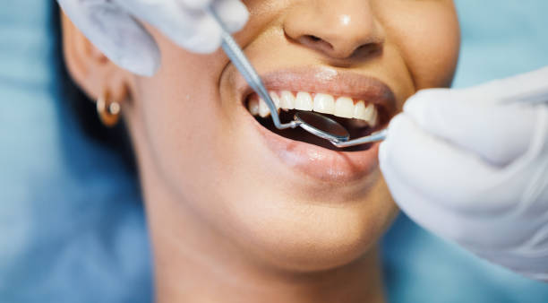 Best Emergency Dental Care for Abscessed Tooth in Windcrest, TX